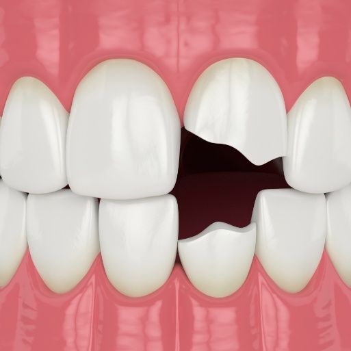 Animated smile with damaged teeth