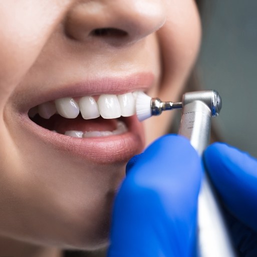 Closeup of smile during dental checkup and teeth cleaning visit