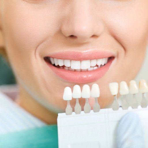 A dentist assessing a woman’s enamel shade for teeth whitening