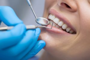 woman at dental cleaning