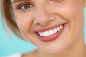 Woman with cosmetically improved smile