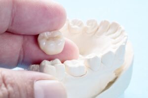 hand holding a dental crown next to a model of teeth