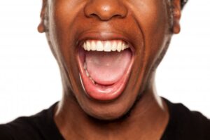 a woman opening her mouth wide to show her tongue, teeth, and gums