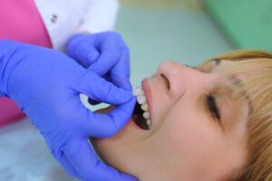 Woman getting her veneers